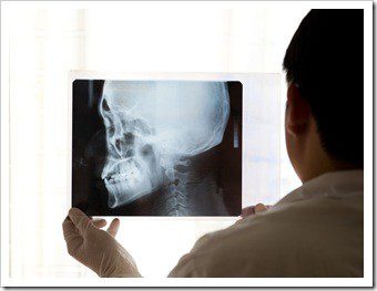 Billings TMJ Jaw Pain Treatment