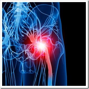 Leg Pain Quincy MA Sciatica