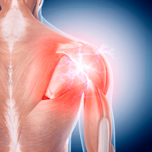 Shoulder Pain Eatonton GA