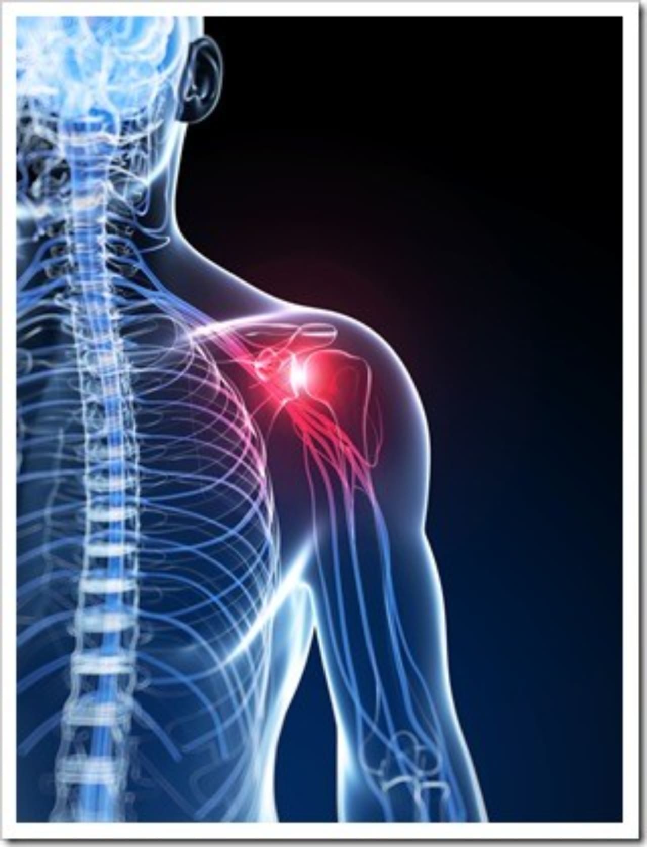Frozen Shoulder Jackson MS Neck Pain