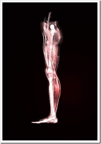 Piriformis Syndrome Eatonton GA Sciatica