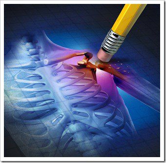 Scar Tissue Jackson MS Chiropractic