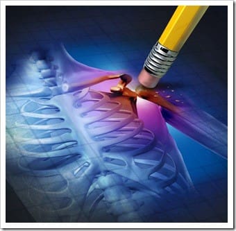 Scar Tissue Eatonton GA Chiropractic