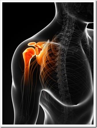 Shoulder Pain Eatonton GA Bursitis